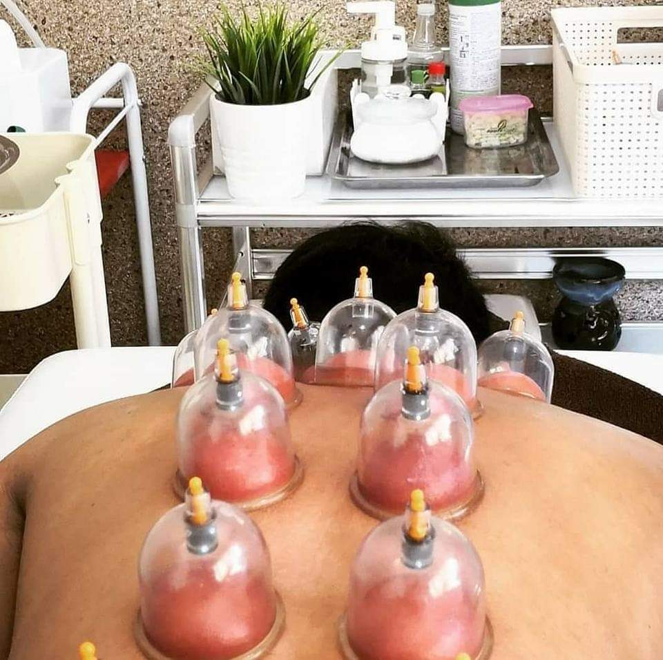 الحجامة الطبية بإتقان وأمآن في قطر مجمع ريحان الطبي